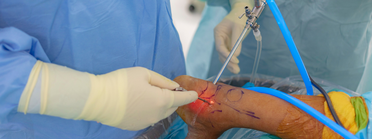 Ankle Scope | FASO Ankle Scope | FASO