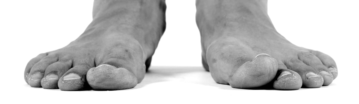 Flatfeet | FASO Flatfeet | FASO