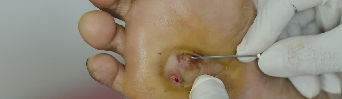 Wound Care | FASO Wound Care | FASO