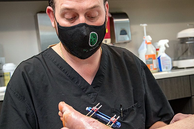 Wound Care Appointment Wound Care Appointment