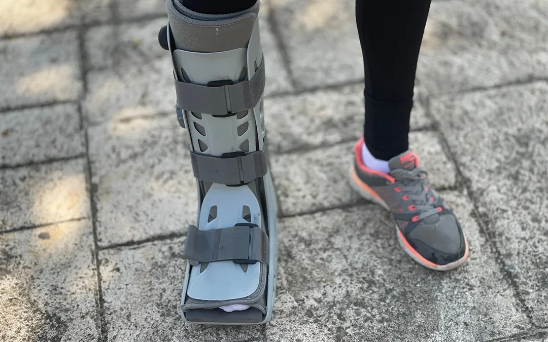 Life in a Walking Boot: The Side Effects Nobody Warns You About
