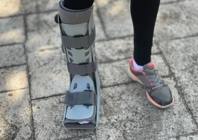 Life in a Walking Boot: The Side Effects Nobody Warns You About