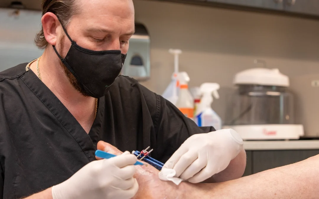Lapiplasty Recovery: The Timeline, and How to Actually Live Through It