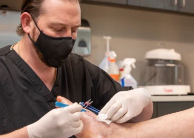 Lapiplasty Recovery: The Timeline, and How to Actually Live Through It