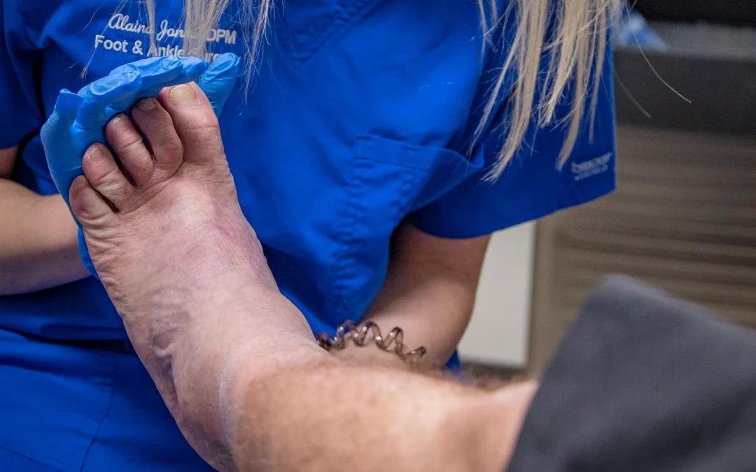 Ingrown Toenail: When to Treat It at Home, and When to Come In