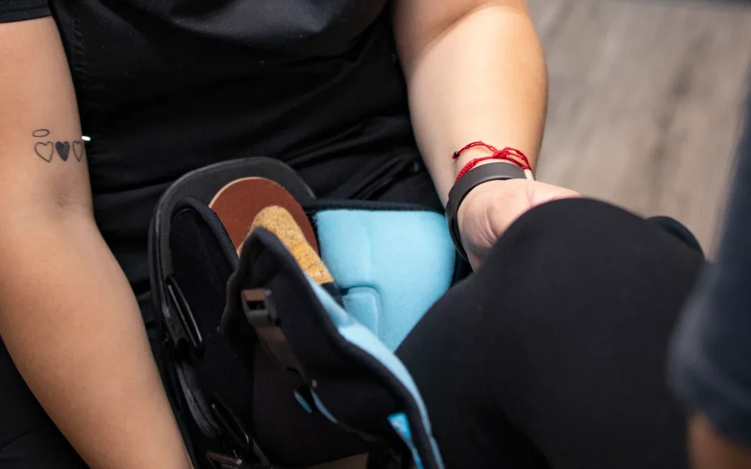 Achilles Tendon Surgery Recovery: The Real Timeline
