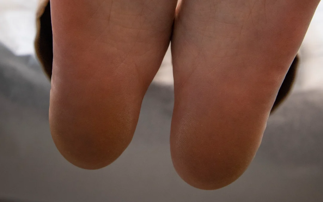 Why Won’t My Plantar Fasciitis Go Away? Three Reasons, and What to Do About Each 